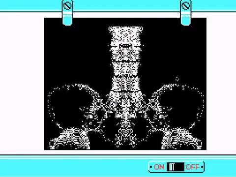 
											X-Ray